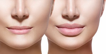 Lips